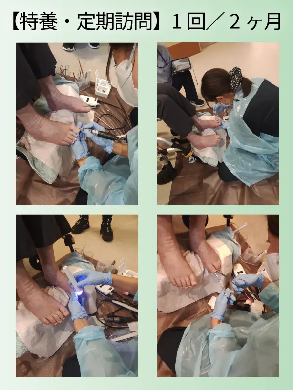 特別養護老人ホームでの施術画像
