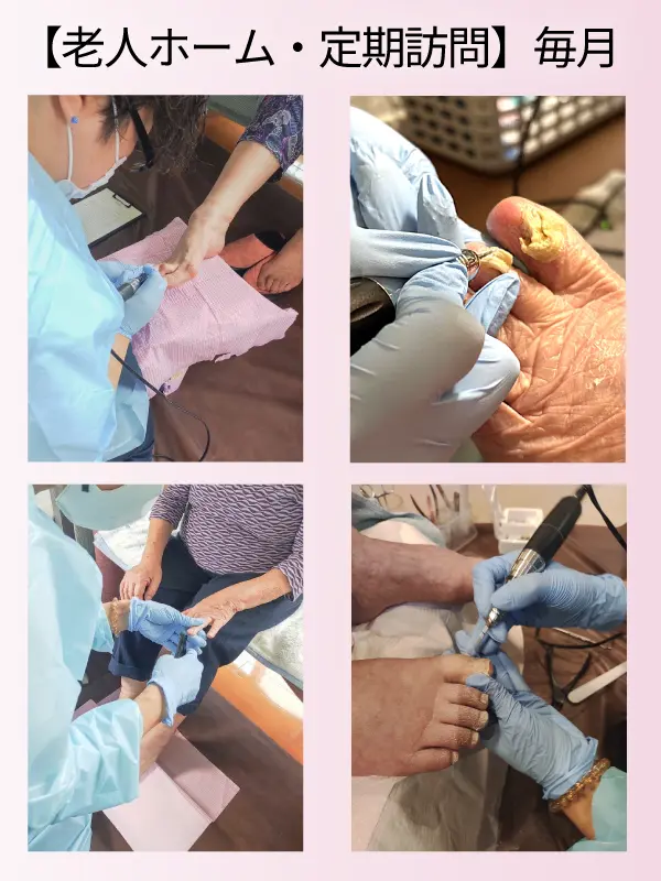 老人ホームでの施術画像