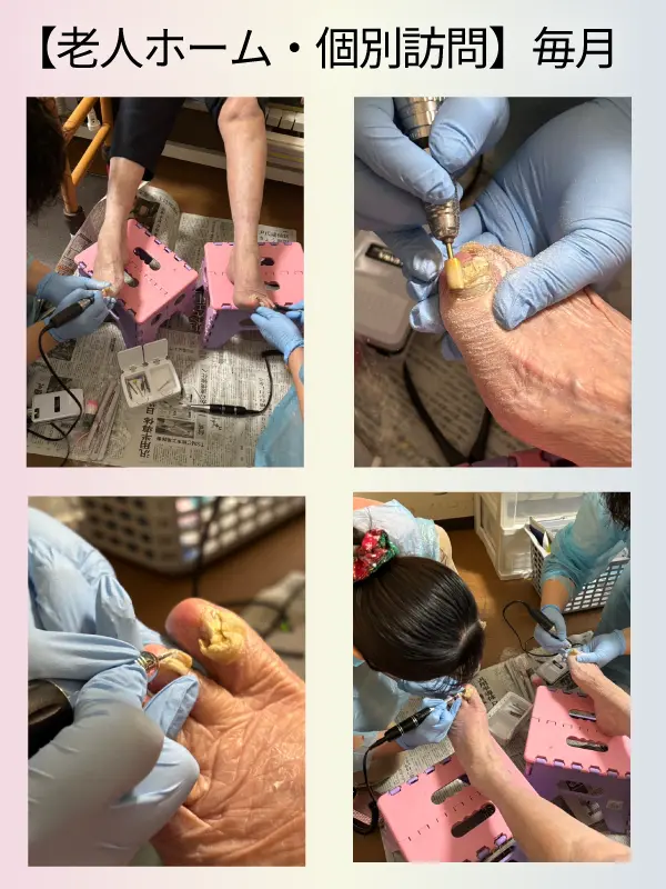 老人ホームでの施術画像