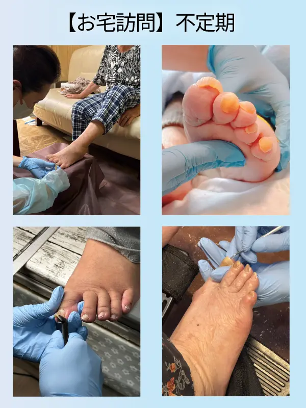 訪問爪切りの施術画像