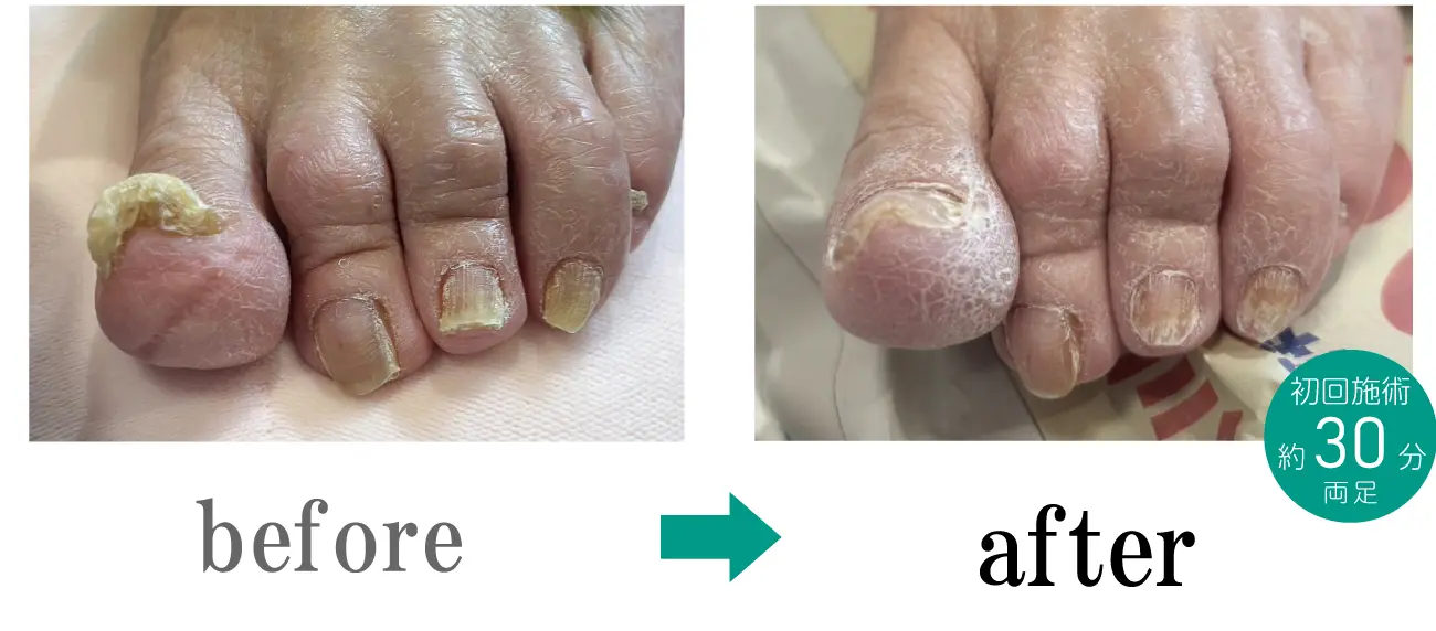 施術のビフォーアフター